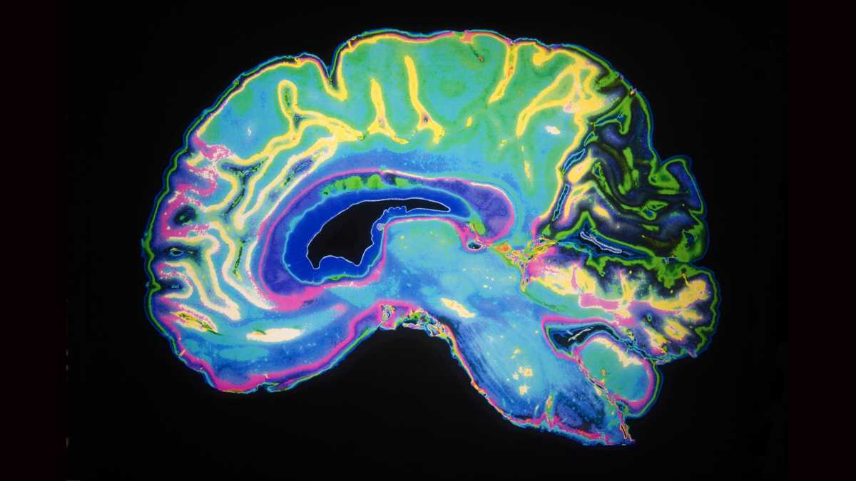 Neurolaw Club Newsletter